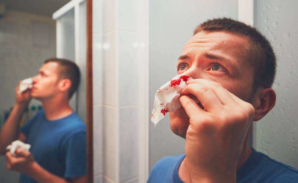 打球时撞到鼻子怎么处理,打球鼻子撞出血了怎么办怎么安慰