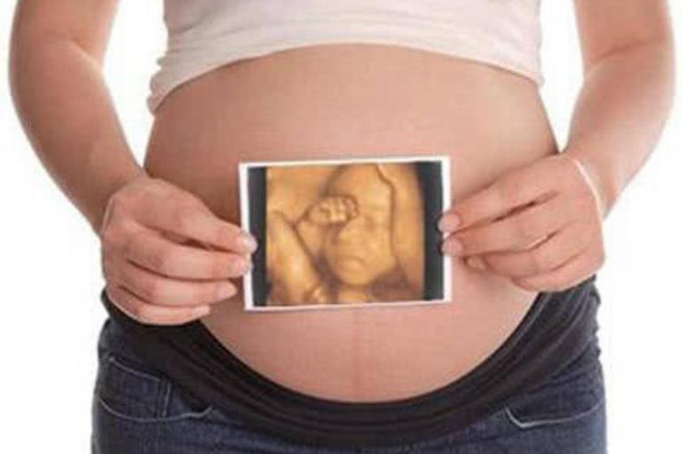 孕妇做b超胎儿在开车视频,b超胎儿开车