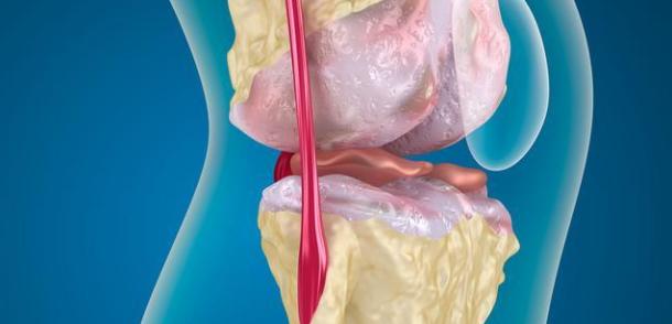 跑完步膝盖疼是怎么回事如何缓解,跑完步后膝盖痛应该怎么解决