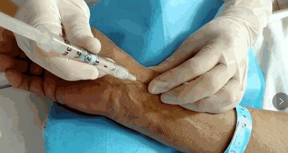 比乙肝厉害的肝病是什么,甲肝和乙肝丙肝的区别哪个危害大