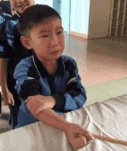 胳膊上的小圆疤是什么,每个人胳膊上的疤是怎么长出来的