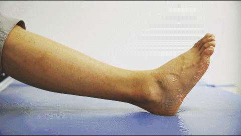 崴脚冰敷的正确做法,崴脚后怎么冰敷和热敷