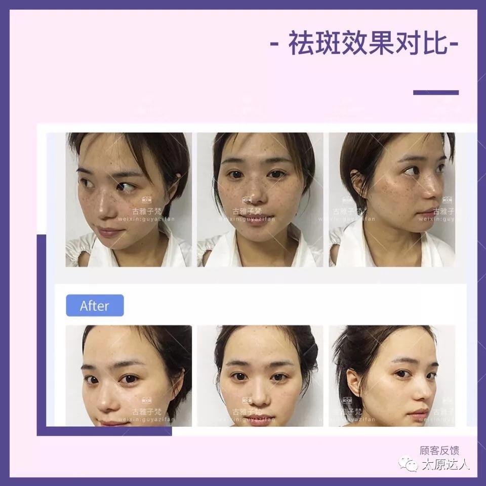 814元人气精华护理免费做！一次就焕颜新生！聚会女王就是你