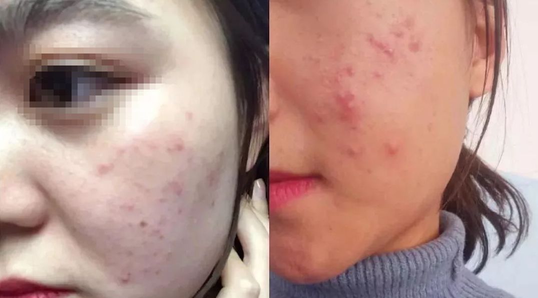 赵露思推荐补水保湿,赵露思推荐水感保湿焕颜面霜