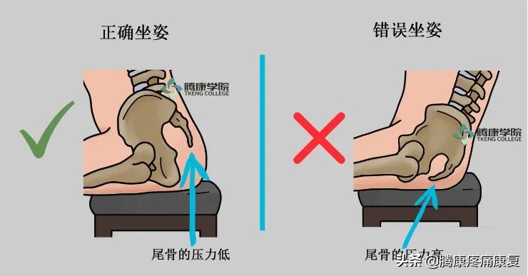 四个缓解尾骨疼痛的方法图片,尾骨摔伤疼痛最快缓解方法