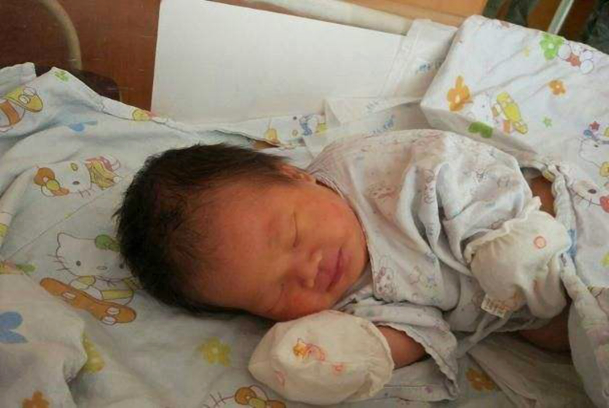 宝宝成为小秃瓢这4个原因要了解,宝宝头发有斑秃是什么原因