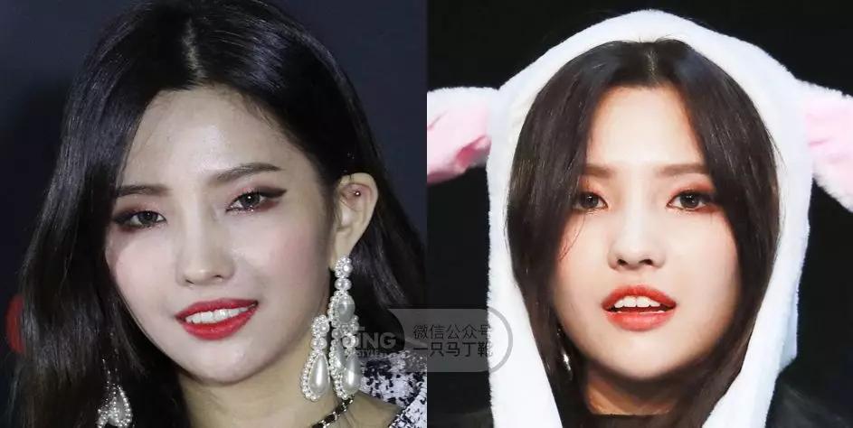 戴牙套凸嘴怎么化妆,凸嘴整牙削骨吗