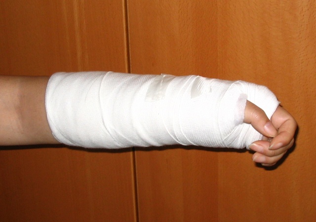 你知道伤筋动骨一百天，但不知道骨折要这样护理，恢复得又快又好