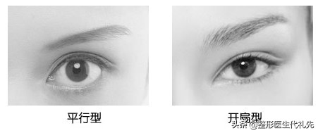 新月形双眼皮好看还是扇形好,新月型与平扇形双眼皮的区别