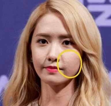 男生会喜欢脸上有痘的吗,男生会喜欢脸上有斑的女生吗