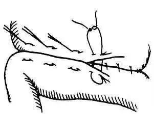 外科缝合方法笔记,兽医外科手术中最常用的缝合方法