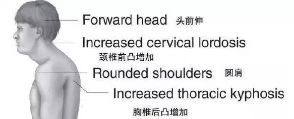 前中斜角综合症,前中斜角肌间沟有多长