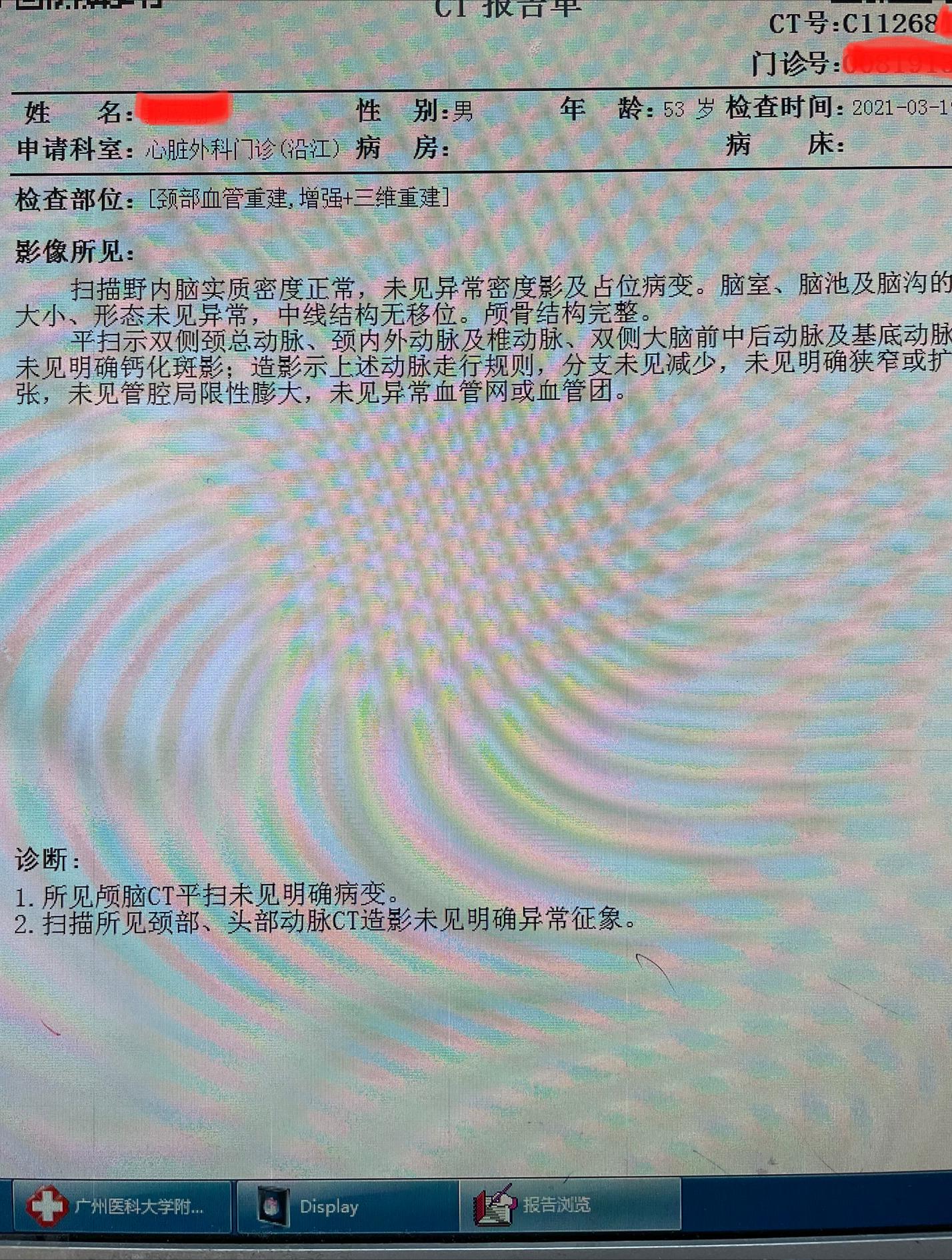 颈动脉狭窄严重可以支架恢复吗,颈动脉狭窄治疗之后心脏会缓解吗