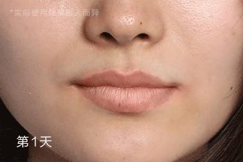 皮肤太白会不会有问题,皮肤太白涂什么好