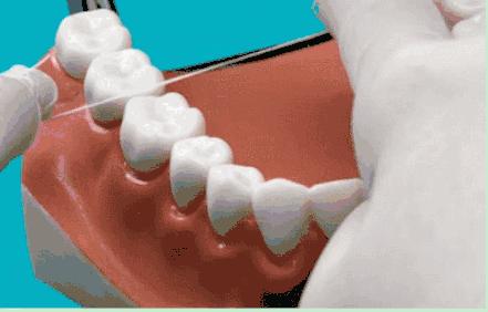 塞牙缝抠不出来没有牙线怎么办,塞牙用牙线刮不干净怎么办