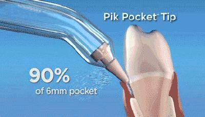 牙齿发黄有菌斑怎么办,牙齿泛黄很脏怎么办