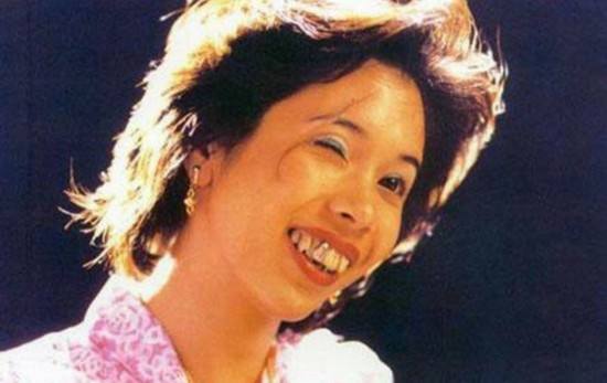 凸嘴皮肤不好怎么逆袭,凸嘴如何逆袭完美侧脸