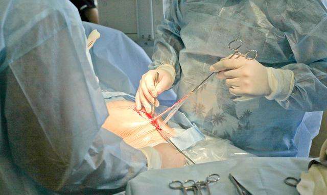 疤痕体质孕妇要注意什么,疤痕体质孕妇剖腹产后疤痕什么样