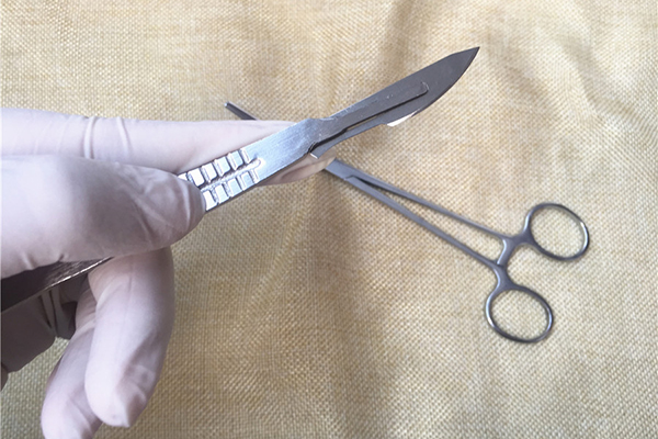 肺部磨玻璃结节0.7x0.6是什么意思,1024靶扫对5mm的磨玻璃结节有用吗