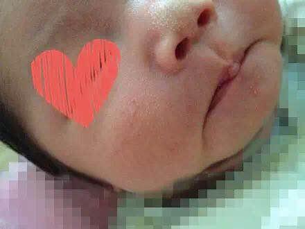 刚出生的宝宝特殊现象,刚出生宝宝吓住了怎么办