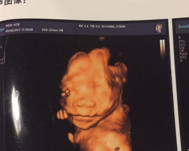 备孕无果要注意什么,备孕苦尽甘来