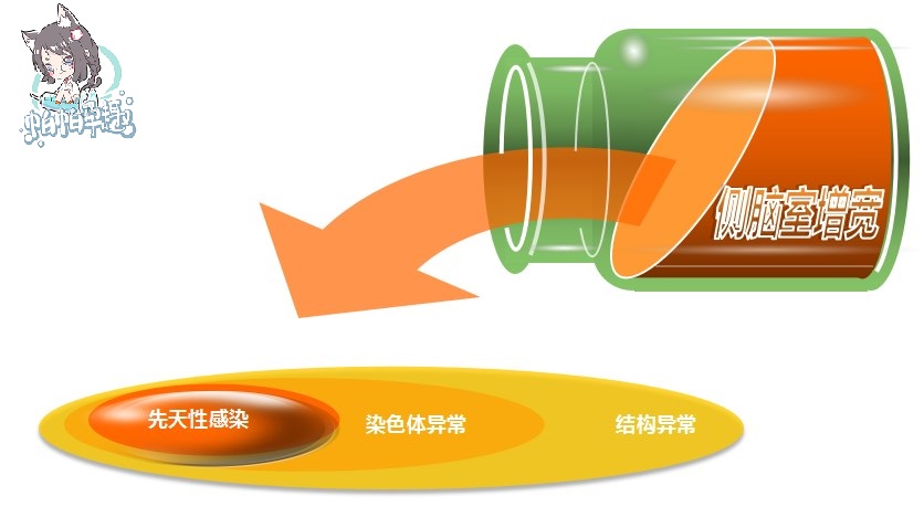 双侧侧脑室增宽18mm没有脑积水,胎儿脑室增宽脑积水怎么办