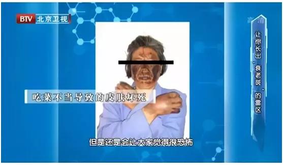 汗疱疹湿疹小妙招,湿疹和汗疱疹反反复复怎么办