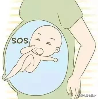 生娃痛到底是哪里痛,疼痛难忍痛不欲生的治疗现场