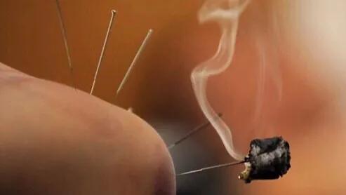 针灸如何治疗膝盖疼痛,膝关节疼痛针灸穴位留针时间