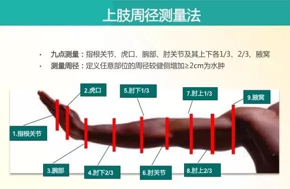 乳腺癌放疗水肿怎样解决,乳腺癌放疗后出现水肿怎么办