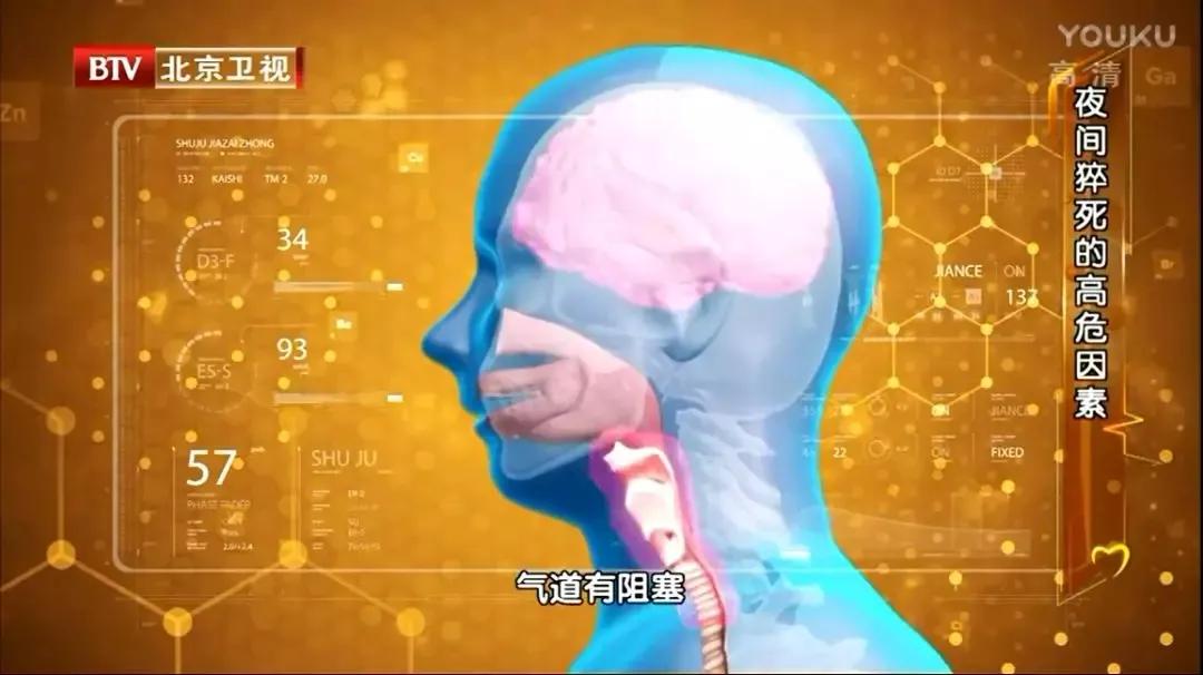 双下巴可不仅仅是胖，还有可能是疾病的信号！尤其是脖子粗过这个数的人，更危险