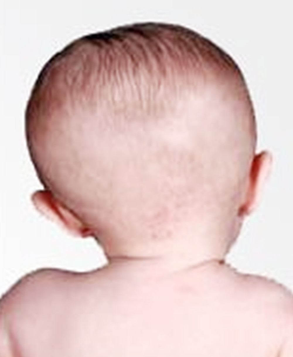 孕期左侧卧睡歪了骨盆,孕期左侧睡宝宝发育不好