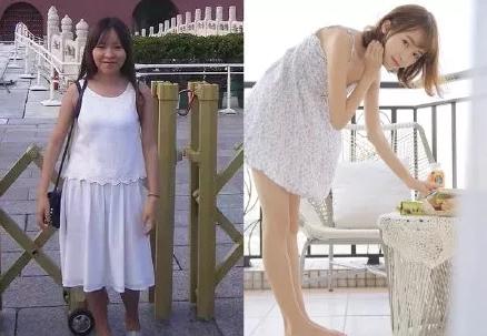 祛痘变白小技巧,祛痘变白了