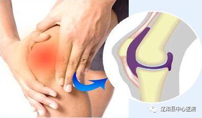 夏天膝关节冷疼怎么治疗,膝关节疼痛的健康宣教