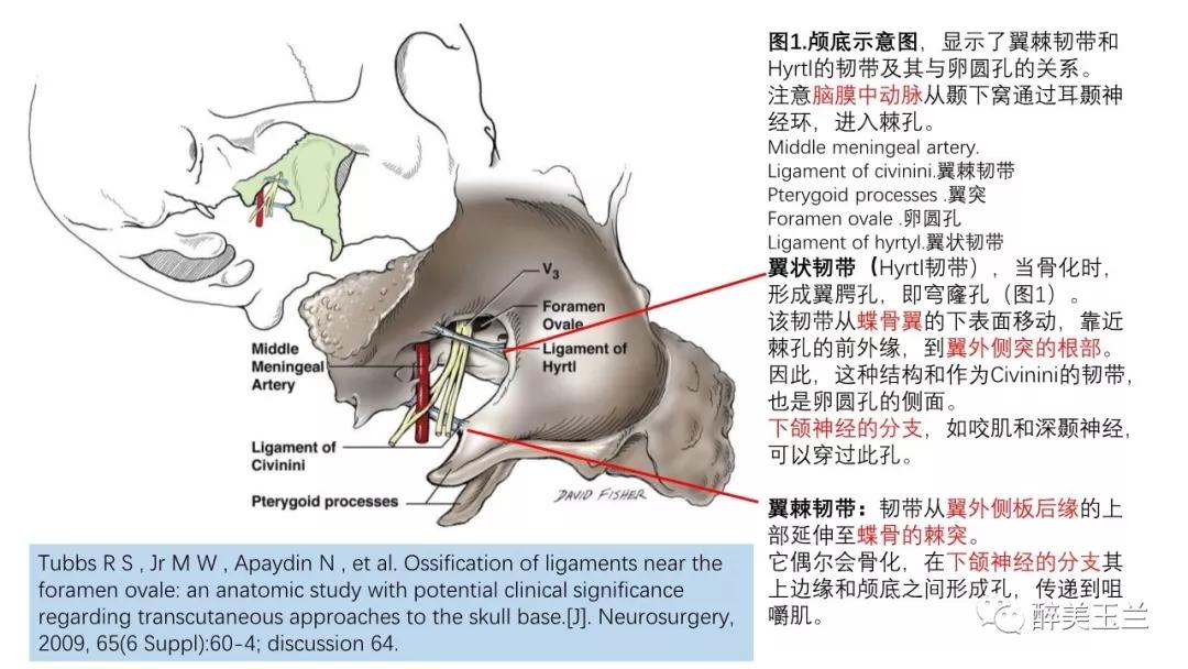 病例分享丨三叉神经节微球囊压迫术的麻醉管理