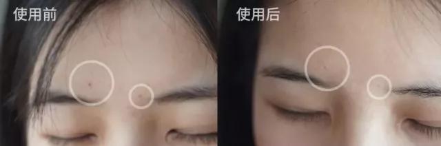 超临界蜂胶与普通蜂胶有几大优点,纯天然蜂胶的作用与功效