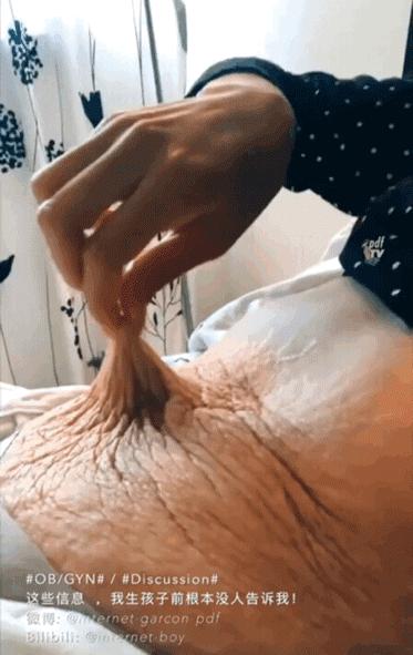 生孩子对女人伤害,生孩子对女人的伤害