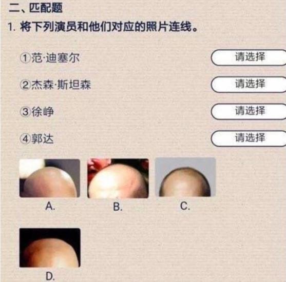 男人脱发这件事是不是就无药可救了