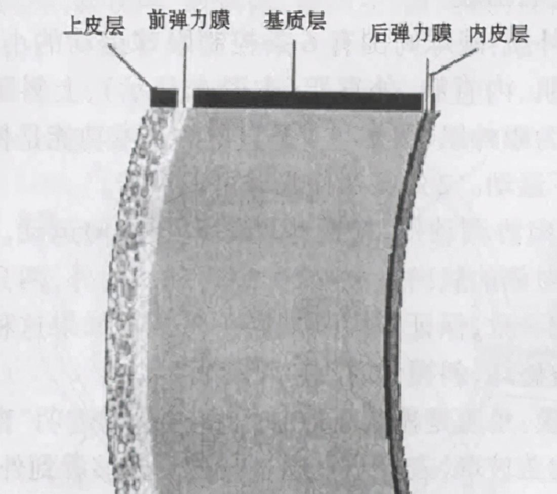 做半飞秒近视眼手术最坏的后果,近视眼手术最佳年龄和度数费用