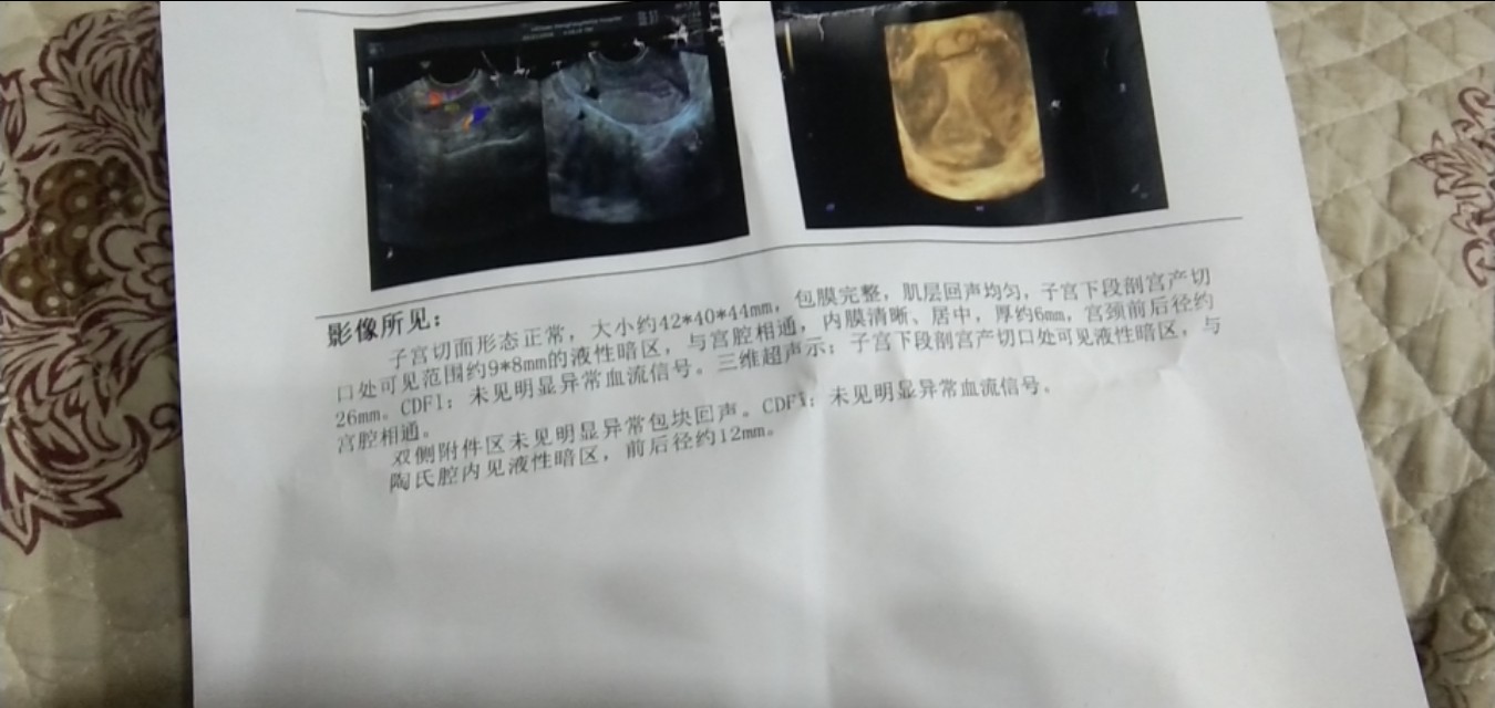 剖腹产的痛体会不到顺产的痛,尝过顺产和剖腹产的痛