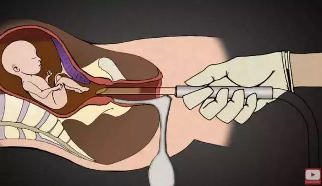 丁嘉丽明星的故事,丁嘉丽央视