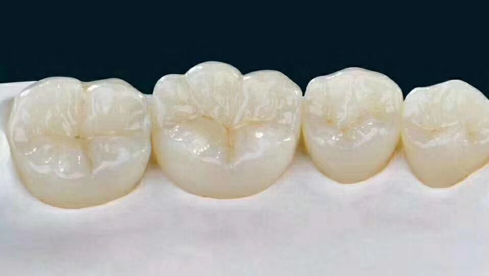 已经有牙洞了怎么根管治疗,牙髓腐烂坏死再做根管治疗会痛吗