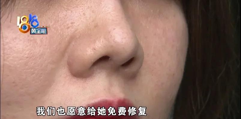 壹加壹做鼻子哪个医生好,壹加壹隆鼻图片