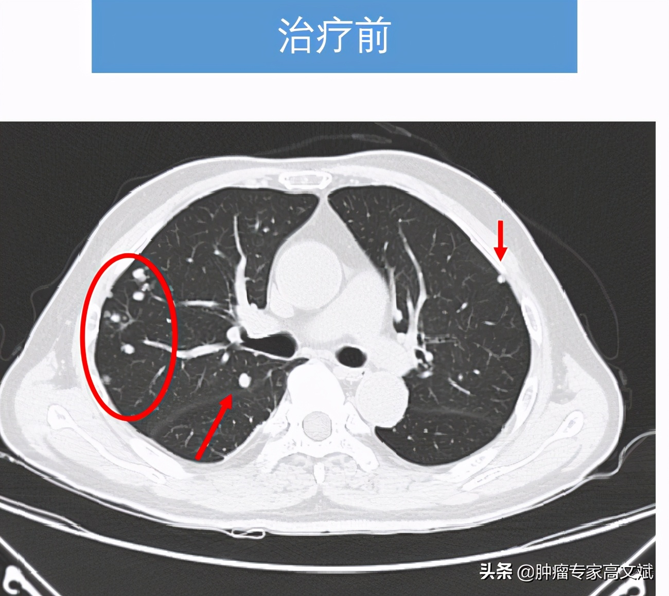 不怕打仗能打胜仗,连续作战能打胜仗