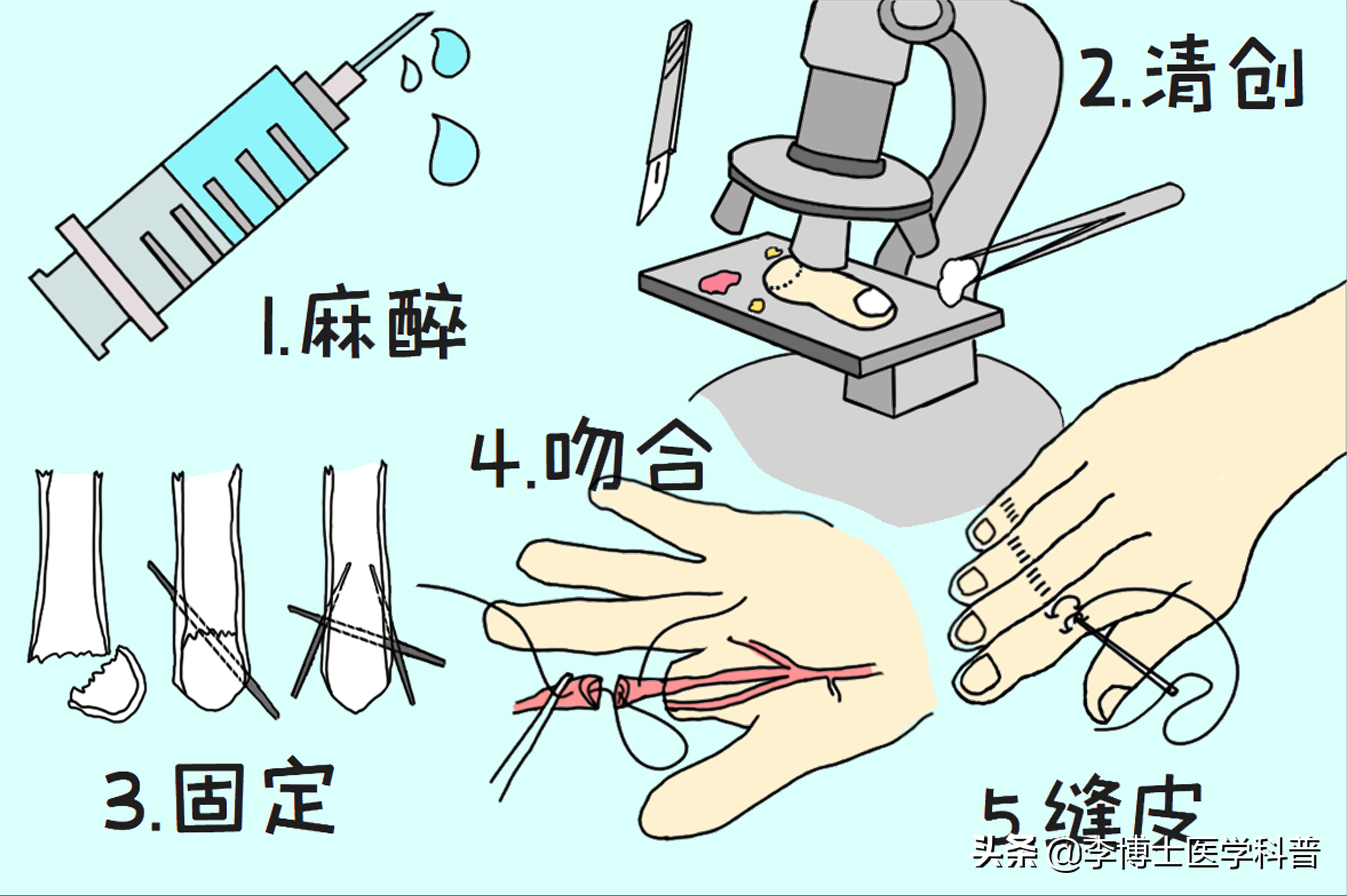 手部外伤急救,手部外伤家庭急救手抄报