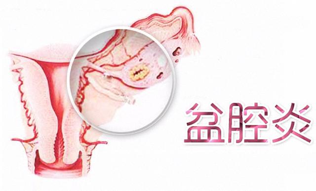 每个女人都会遇到哪些妇科病,常见的女性妇科问题