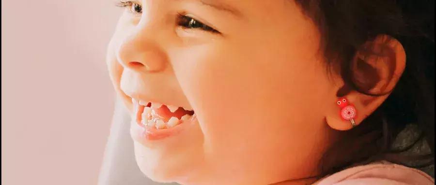 宝宝有的牙缝宽是什么原因,宝宝的牙缝越来越宽是什么原因