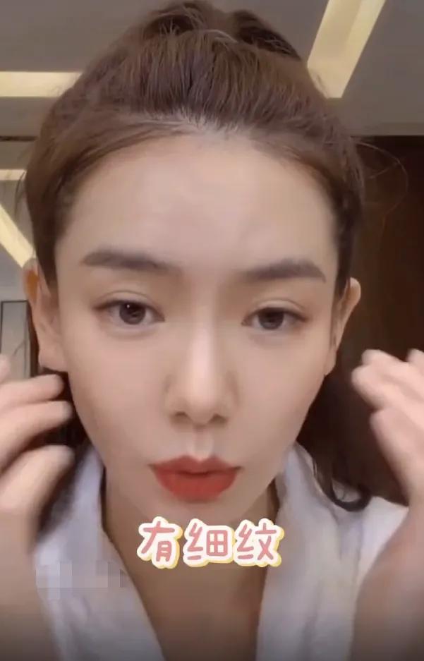 戚薇眼睛双眼皮前后,戚薇双眼皮前后对比照真实