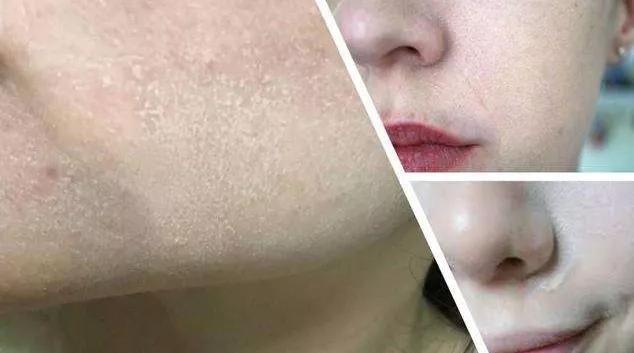 媲美“刘诗诗的百万修图师”，有了这款面膜，你也能拥有好皮肤