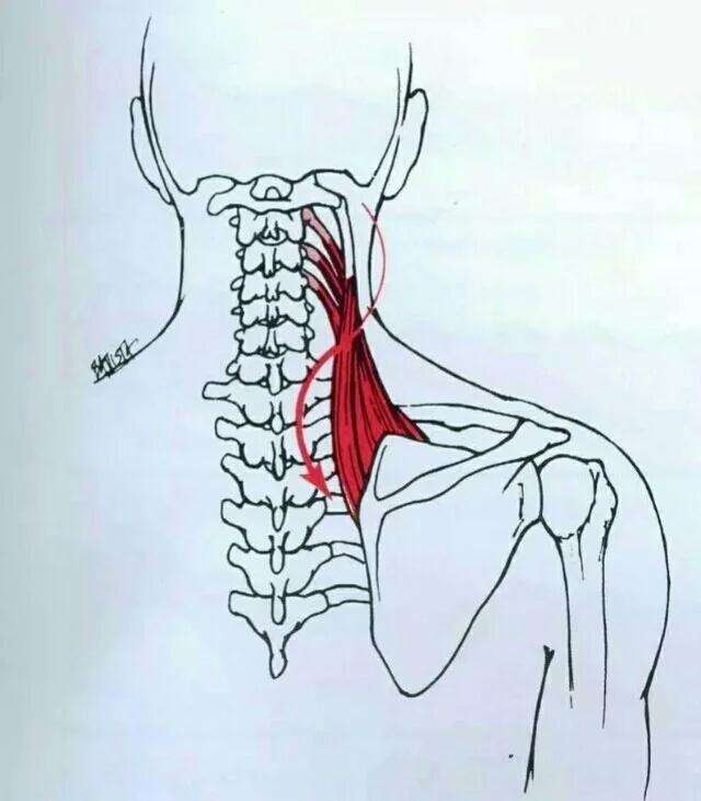 溜肩，长得再瘦体型也垮垮的。但溜肩常见这两种情况，别练错